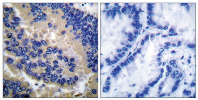 Anti-CSPN3 (Cleaved-Asp175) antibody produced in rabbit affinity isolated antibody