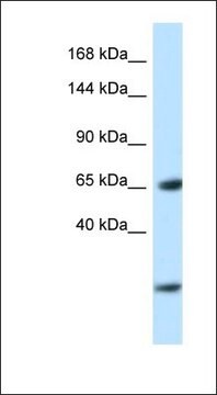 抗EBF3抗体 ウサギ宿主抗体 affinity isolated antibody