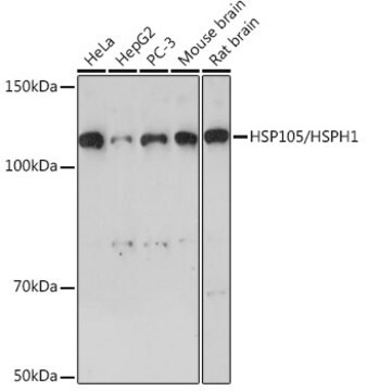 Anti-HSP105/HSPH1 Antibody, clone 9Y7M10, Rabbit Monoclonal