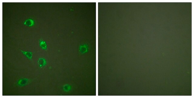 Anti-Glucagon antibody produced in rabbit affinity isolated antibody