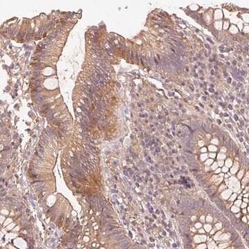 Anti-RALA antibody produced in rabbit Prestige Antibodies&#174; Powered by Atlas Antibodies, affinity isolated antibody, buffered aqueous glycerol solution