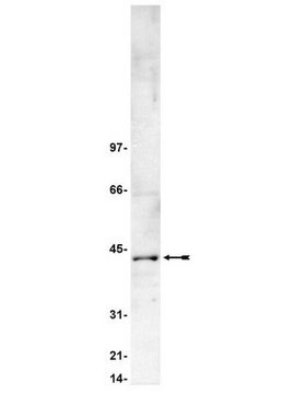 Anti-Casein Kinase 2 Antibody Upstate&#174;, from rabbit