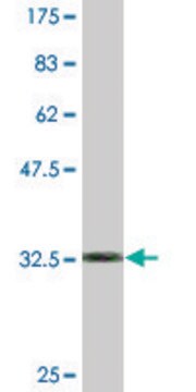 Monoclonal Anti-SPOP, (C-terminal) antibody produced in mouse clone 3E2, purified immunoglobulin, buffered aqueous solution