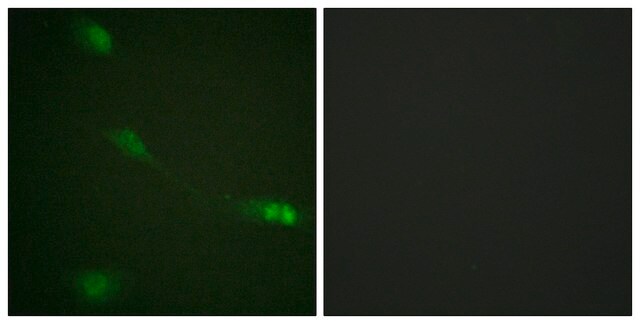 抗 MDM2 兔抗 affinity isolated antibody