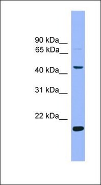 Anti-KLF4 antibody produced in rabbit affinity isolated antibody