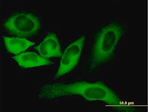 Monoclonal Anti-FASN antibody produced in mouse clone 3B3-1D6, purified immunoglobulin, buffered aqueous solution