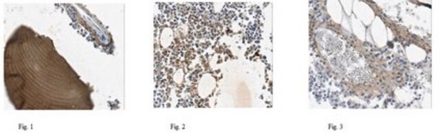 Anti-COL1A2, clone alpha2CT, Azide Free Antibody clone alpha2CT, from mouse