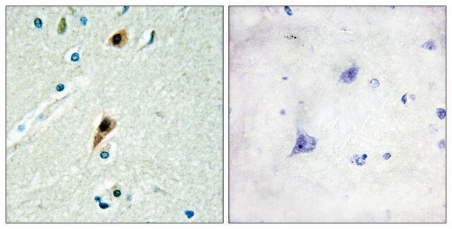 Anti-RBM5 antibody produced in rabbit affinity isolated antibody