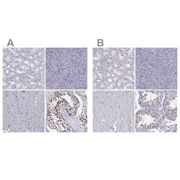 Anti-PPM1G antibody produced in rabbit Prestige Antibodies&#174; Powered by Atlas Antibodies, affinity isolated antibody, buffered aqueous glycerol solution