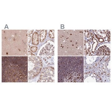 Anti-TOR1AIP1 antibody produced in rabbit Prestige Antibodies&#174; Powered by Atlas Antibodies, affinity isolated antibody, buffered aqueous glycerol solution