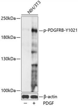 Anti-Phospho-PDGFRB-Y1021 antibody produced in rabbit