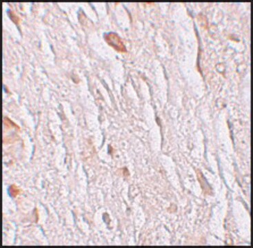 Anti-ZIP7 antibody produced in rabbit affinity isolated antibody