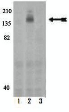 Anti-phospho-c-Kit (Tyr568/Tyr570) Antibody Upstate&#174;, from rabbit