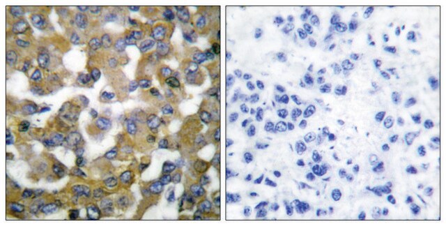 抗ケラチン19 ウサギ宿主抗体 affinity isolated antibody