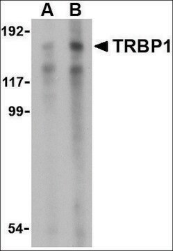 Anti-TRBP1 antibody produced in rabbit affinity isolated antibody, buffered aqueous solution