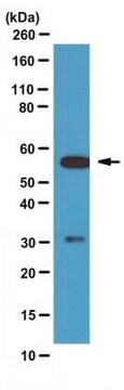 Anti-Calcineurin-pan-A-Antikörper from rabbit, purified by affinity chromatography