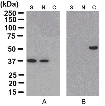 Kit d'enrichissement et d'isolement du cytosquelette ProteoExtract&#174; This kit provides cytoskeleton purification detergent buffers, sufficient for extraction from ten 100 mm culture dishes, that retain focal adhesion &amp; actin-associated proteins while removing soluble cytoplasmic &amp; nuclear proteins from the cell.