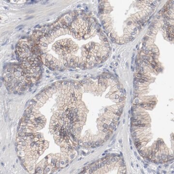 Anti-ADRB2 antibody produced in rabbit Prestige Antibodies&#174; Powered by Atlas Antibodies, affinity isolated antibody, buffered aqueous glycerol solution