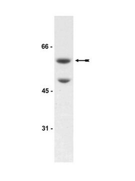 Anti-Akt3/PKB&#947; Antibody Upstate&#174;, from rabbit