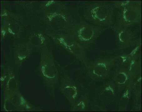 Anti-TGN38 in Kaninchen hergestellte Antikörper ~1&#160;mg/mL, affinity isolated antibody, buffered aqueous solution