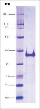 Vitamin D receptor (118-427), His tagged human recombinant, expressed in E. coli, &#8805;70% (SDS-PAGE)