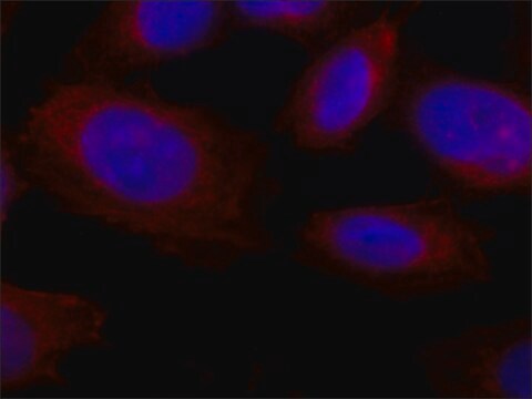 Przeciwciało antykolagenowetypu X, mysie monoklonalne clone COL-10, purified from hybridoma cell culture