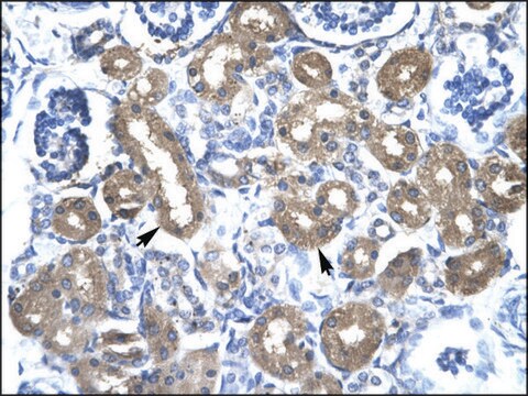 Anti-CBX4 antibody produced in rabbit affinity isolated antibody