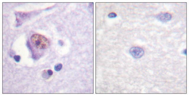 Anti-SOX9 antibody produced in rabbit affinity isolated antibody