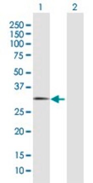 Anti-FBXO44 antibody produced in rabbit purified immunoglobulin, buffered aqueous solution