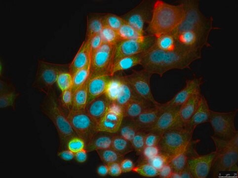 HCC95 Human Lung Squamous Carcinoma Cell Line