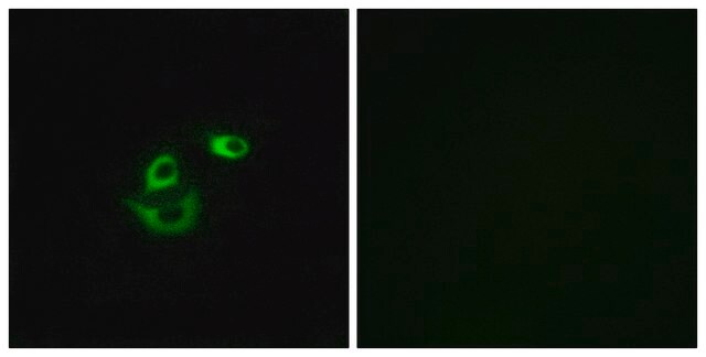 Anti-CLCC1 antibody produced in rabbit affinity isolated antibody