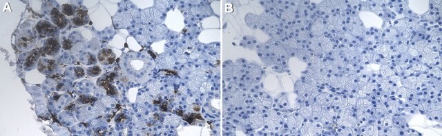 Anti-Lactotransferrin Antibody, clone 1D15 ZooMAb&#174; Rabbit Monoclonal recombinant, expressed in HEK 293 cells