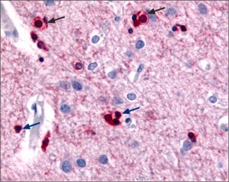 Anti-Potassium Channel SK2 antibody produced in rabbit affinity isolated antibody, lyophilized powder