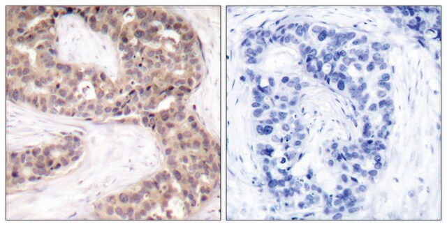 Anti-G3BP-1 antibody produced in rabbit affinity isolated antibody