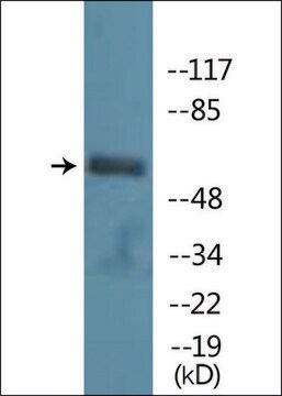 Anti-phospho-PAK1 (pSer199) antibody produced in rabbit affinity isolated antibody