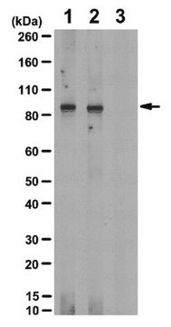 Anti-phospho-IGF-1R (Tyr1161/Tyr1165/Tyr1166)-Antikörper from rabbit, purified by affinity chromatography