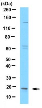 Anti-dUTPase Antibody from rabbit