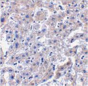 Anti-Caspase-14 Antibody from rabbit, purified by affinity chromatography