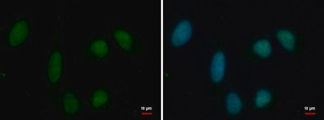 Monoclonal Anti-PRMT1 antibody produced in mouse clone GT779, affinity isolated antibody