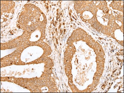 Anti-PRDX4 affinity isolated antibody