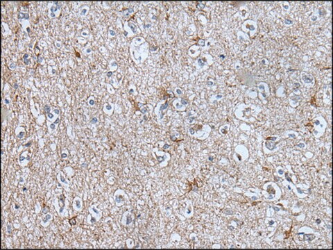 Anty-BMP1 affinity isolated antibody