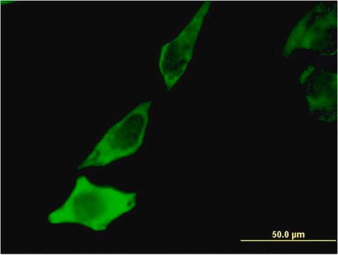 抗-BDNF单克隆抗体 小鼠抗 clone 1B10, purified immunoglobulin, buffered aqueous solution