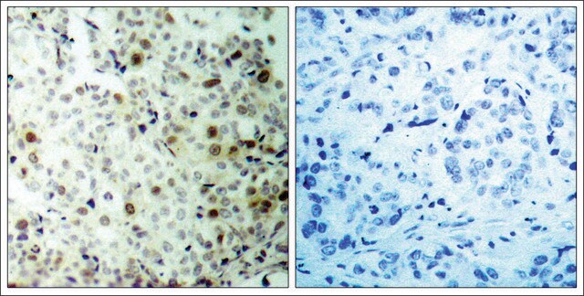 Anti-phospho-CDK2 (pThr160) antibody produced in rabbit affinity isolated antibody