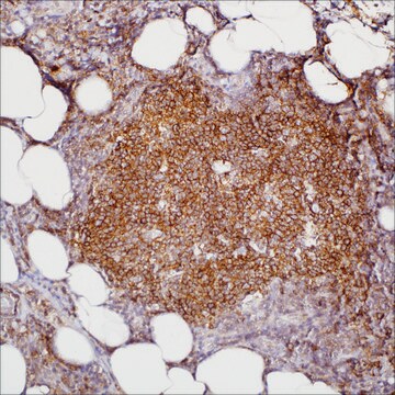 HGAL (MRQ-49) Mouse Monoclonal Antibody