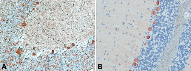 抗ミオシンVa (LE-16)抗体 ウサギ宿主抗体 ~0.5&#160;mg/mL, affinity isolated antibody, buffered aqueous solution