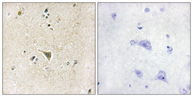 Anti-LRRK1 antibody produced in rabbit affinity isolated antibody