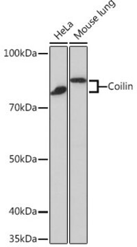 Anti-Coilin Antibody, clone 7Z4K1, Rabbit Monoclonal