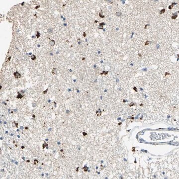 Anti-ADAMTS5 antibody produced in rabbit Prestige Antibodies&#174; Powered by Atlas Antibodies, affinity isolated antibody, buffered aqueous glycerol solution