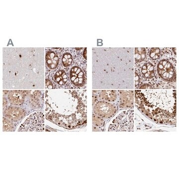 Anti-PSMD7 antibody produced in rabbit Prestige Antibodies&#174; Powered by Atlas Antibodies, affinity isolated antibody, buffered aqueous glycerol solution