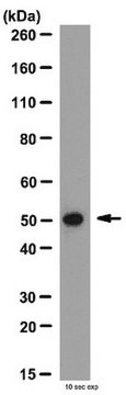 Anti-MMP-1 Antibody, hinge region from rabbit, purified by affinity chromatography